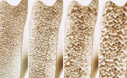Unlocking the Skeleton’s Secret: How GPR133 Could Revolutionize Osteoporosis Treatment