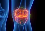 Beyond Symptom Masking: Yale Researchers Unveil Dual-Action Treatment for Osteoarthritis