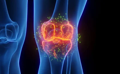 Beyond Symptom Masking: Yale Researchers Unveil Dual-Action Treatment for Osteoarthritis