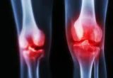 Breaking the Cycle of Chronic Pain: Could Genicular Artery Embolization Redefine Osteoarthritis Care?
