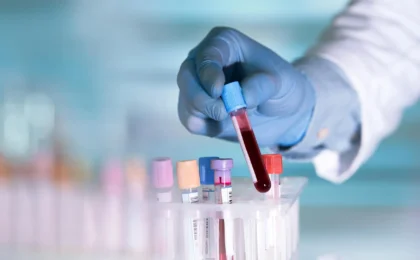 Decoding the Decade: Scientists Uncover Immune ‘Fingerprints’ That Predict IBD Years Before Diagnosis
