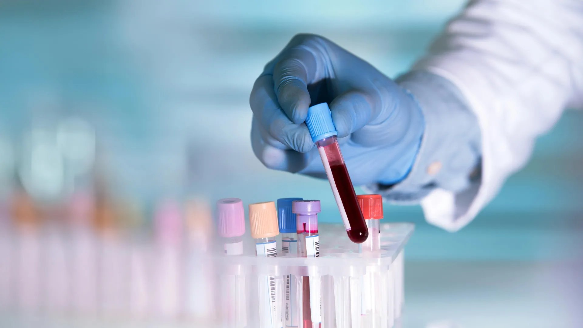 Decoding the Decade: Scientists Uncover Immune ‘Fingerprints’ That Predict IBD Years Before Diagnosis