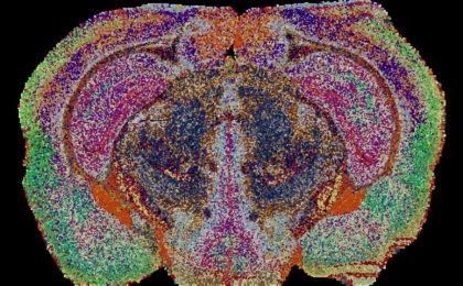 The Hidden Blueprint: How a New ‘Lipid Atlas’ Is Rewriting Our Understanding of the Brain