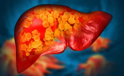 The Hidden Toll: How Ubiquitous Polyethylene Microplastics May Be Fueling a Global Liver Crisis