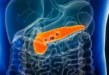 The Silent Sentinel: How AI Breakthrough REDMOD is Rewriting the Future of Pancreatic Cancer Detection